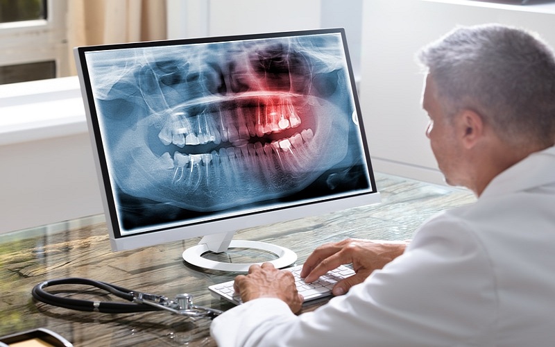 The significance of dental x-rays in a general dentist’s work