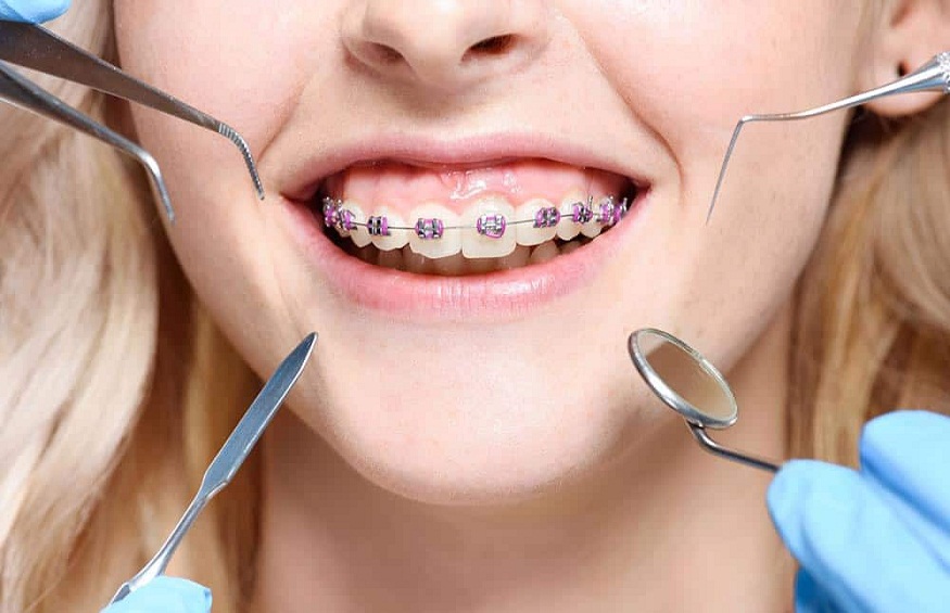 The Role Of Orthodontics In Treating Sleep Disorders
