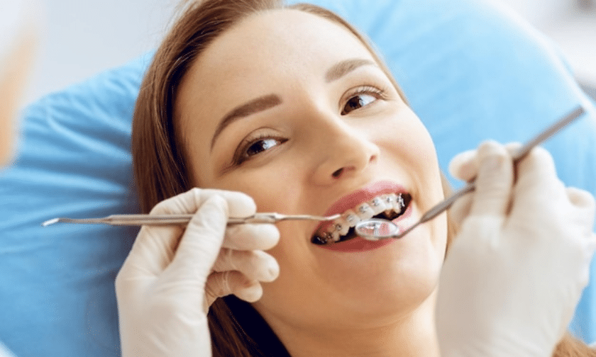 Orthodontic Myths D