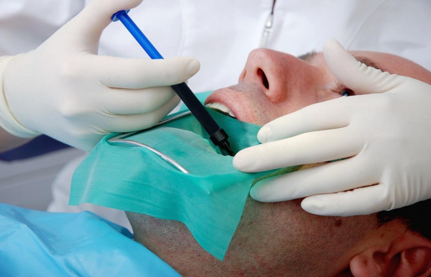 Explaining The Process Of Root Canal Treatment: A General Dentist’s Perspective