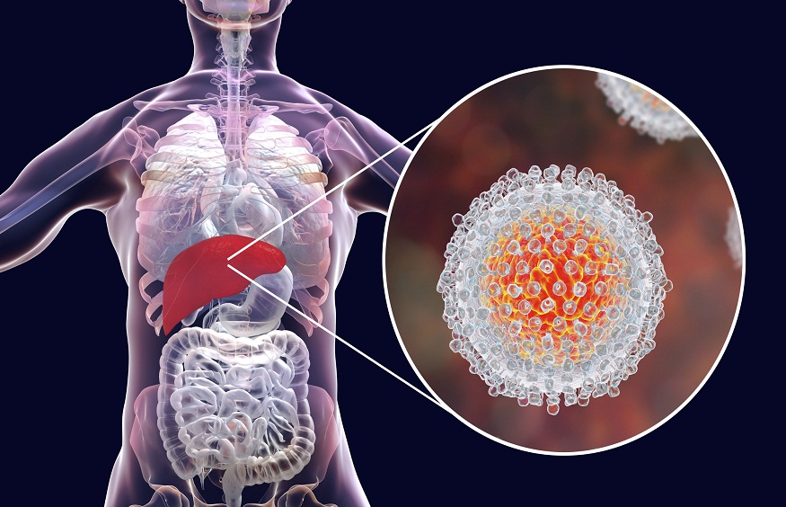 Treatment Of Hepatitis