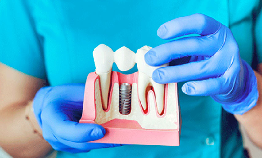 Implant Dentist's