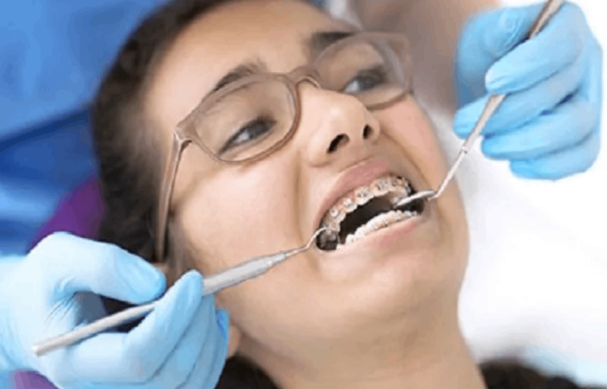 Benefits Of Orthodontic Treatment